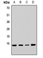 Anti-RPL23 Antibody
