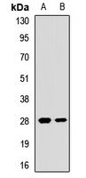 Anti-EIF4E2 Antibody