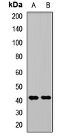 Anti-RCL1 Antibody