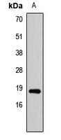 Anti-SAP18 Antibody