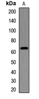Anti-IGF2BP3 Antibody