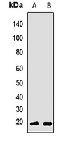 RBBP9 antibody