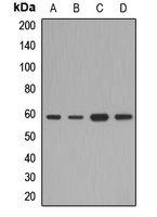 Anti-SAP61 Antibody