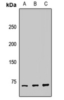 TRIOBP antibody