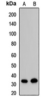 Anti-EXOSC8 Antibody