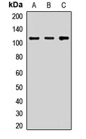 Anti-KAP3 Antibody