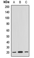 Anti-BLOC1S6 Antibody