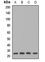 UBE2S antibody