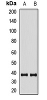 Anti-XLF Antibody