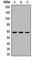 Anti-LPCAT1 Antibody