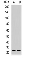 Anti-CBR4 Antibody