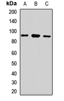 Anti-LARP4 Antibody