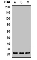 UBE2F antibody