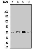 Anti-BACE1 Antibody