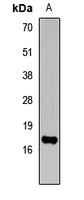 Anti-Histone H3 (TriMethyl-K14) Antibody