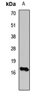 Anti-Histone H3 (TriMethyl-K14) Antibody