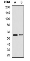 Anti-PEPD Antibody