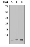 Anti-MGP Antibody