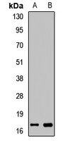 Anti-Myoglobin Antibody