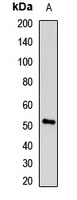 Anti-UMPS Antibody