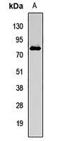 FUBP1 antibody