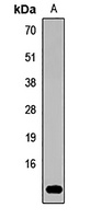 Anti-GNRH1 Antibody