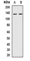 Anti-ECE1 Antibody