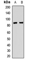 Anti-ERCC2 Antibody