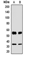 ATP1B1 antibody