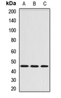 SERPINA6 antibody