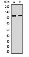Anti-EPC1 Antibody