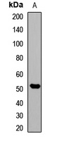 pan methyl-lysine antibody