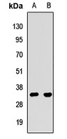 Anti-SBDS Antibody
