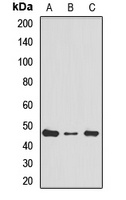 Anti-RPL4 Antibody