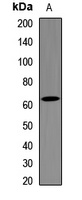 Anti-Metadherin Antibody