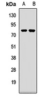 Anti-PABPC4 Antibody