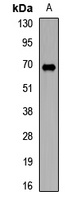 Anti-TRMT2A Antibody