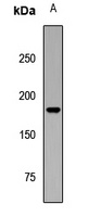 Anti-AQR Antibody