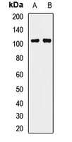 Anti-PIWIL2 Antibody
