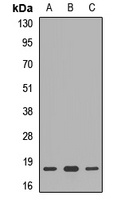 Anti-RPS10 Antibody
