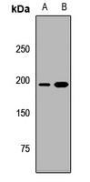 Anti-RICTOR Antibody
