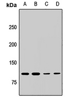 Anti-MLL5 Antibody