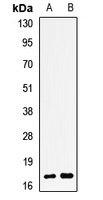 Anti-TSSC3 Antibody