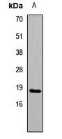 IL17F antibody