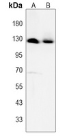 Anti-GLI2 Antibody