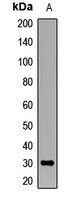 Anti-LPAAT beta Antibody