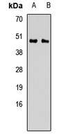 Anti-CALU Antibody