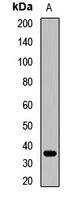 Anti-CRHBP Antibody