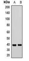 KHDRBS3 antibody