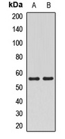 Anti-MATK Antibody